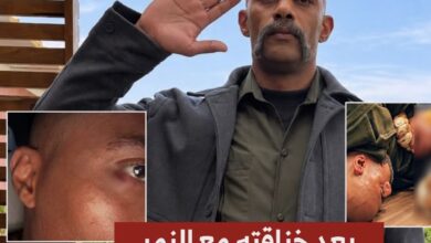 للمرة الثانية.. إصابة محمد رمضان في عينه أثناء تصوير «عشماوي» بعد خناقته مع النمر! ماذا حدث للمرة الثانية.. إصابة محمد رمضان في عينه أثناء تصوير «عشماوي» بعد خناقته مع النمر! ماذا حدث